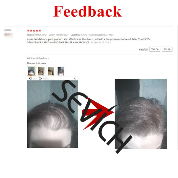 Positive customer review with before and after photos highlighting the effectiveness of Sevich Hair Building Fibers Keratin Thickening Powder.