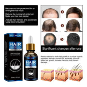 Hair Growth Oil Fast Repair for Hair Loss and Baldness