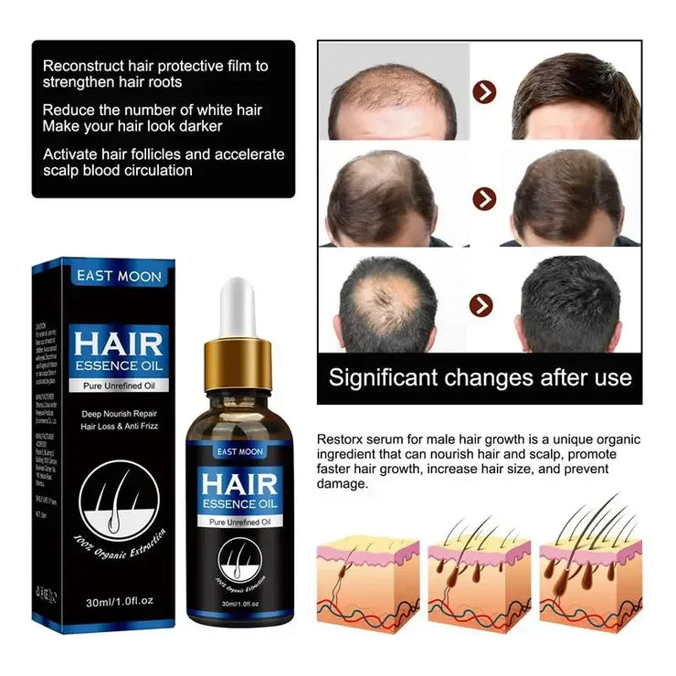 Hair Growth Oil Fast Repair for Hair Loss and Baldness