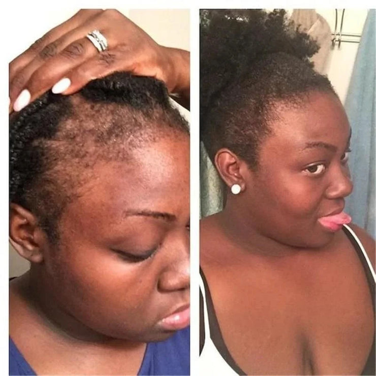 Rosemary Onion Shampoo Anti Hair Loss