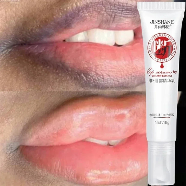 Lippen Rosa Aufhellungscreme Aufhellung Feuchtigkeitsspendend