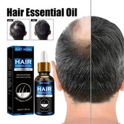 Hair Growth Oil Fast Repair for Hair Loss and Baldness