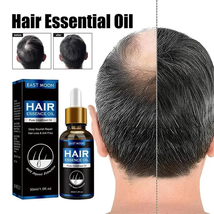 Hair Growth Oil Fast Repair for Hair Loss and Baldness