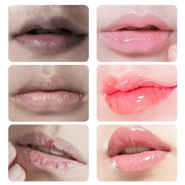 Lippen Rosa Aufhellungscreme Aufhellung Feuchtigkeitsspendend