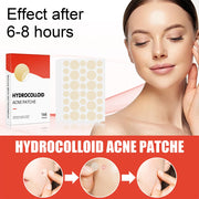 Acne Pimple Patches Invisible Spot Treatment