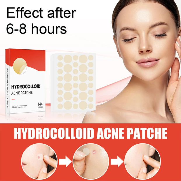 Acne Pimple Patches Invisible Spot Treatment