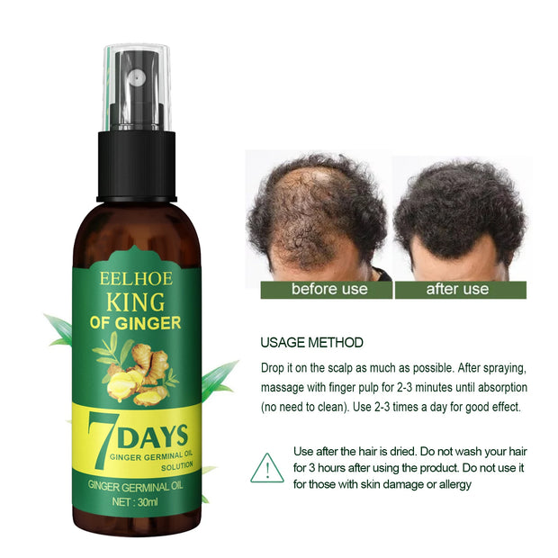 Ginger Hair Growth Spray Anti Hair Loss Scalp Nourishing Essence