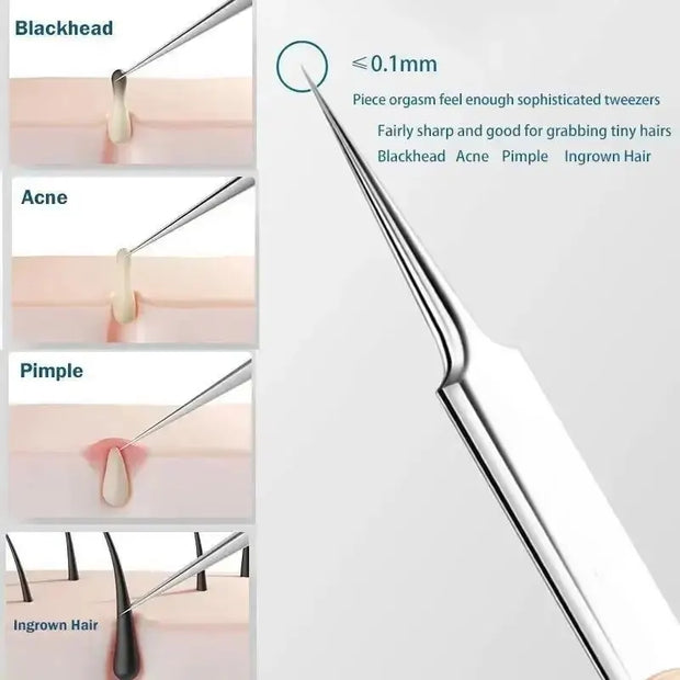 Ingrown Hair and Blackhead Removal Kit