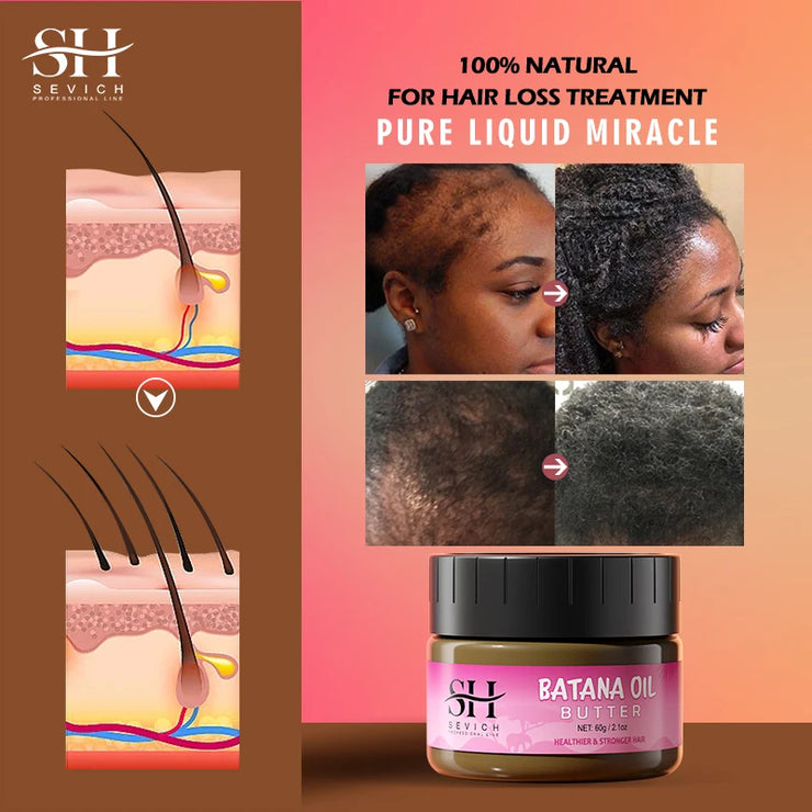 Hair Growth and Anti Hair Loss Treatment