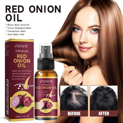 Hair Growth Oil Anti Hair Loss Spray for Thicker Fuller Hair with red onion extract, shown with before and after scalp results and product packaging.