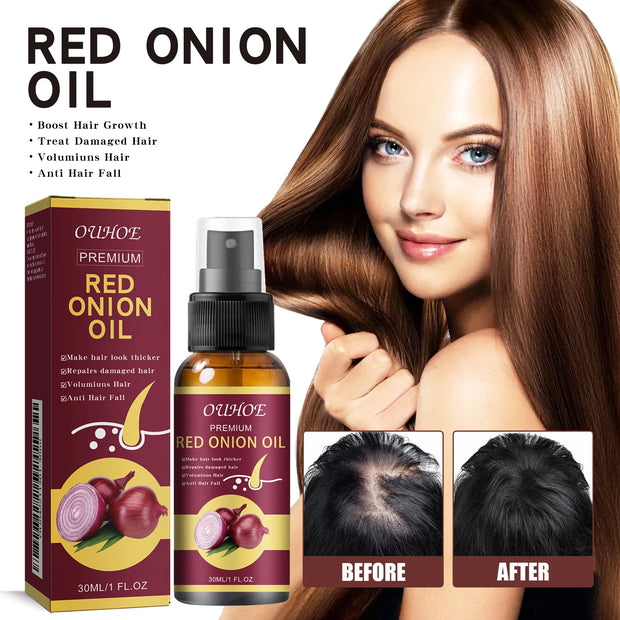 Hair Growth Oil Anti Hair Loss Spray for Thicker Fuller Hair with red onion extract, shown with before and after scalp results and product packaging.