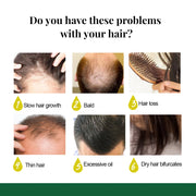 Ginger Hair Growth Spray Anti Hair Loss Scalp Nourishing Essence