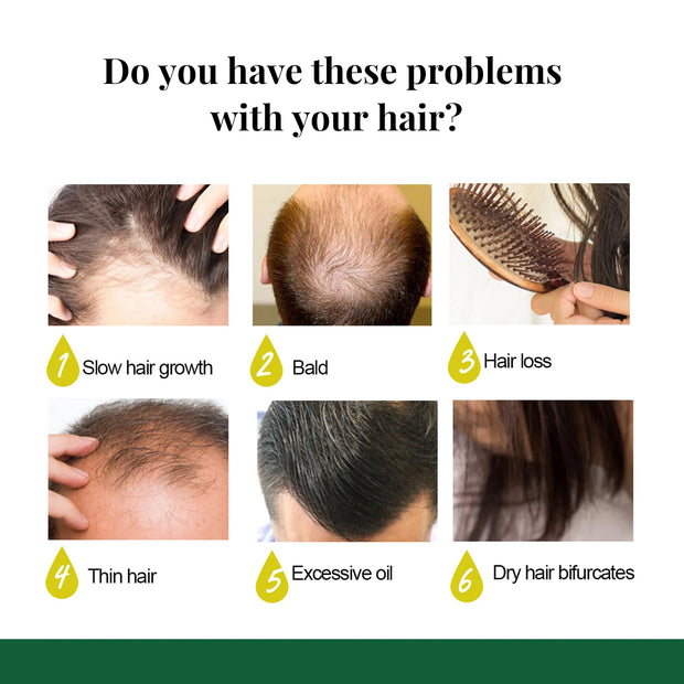 Ginger Hair Growth Spray Anti Hair Loss Scalp Nourishing Essence