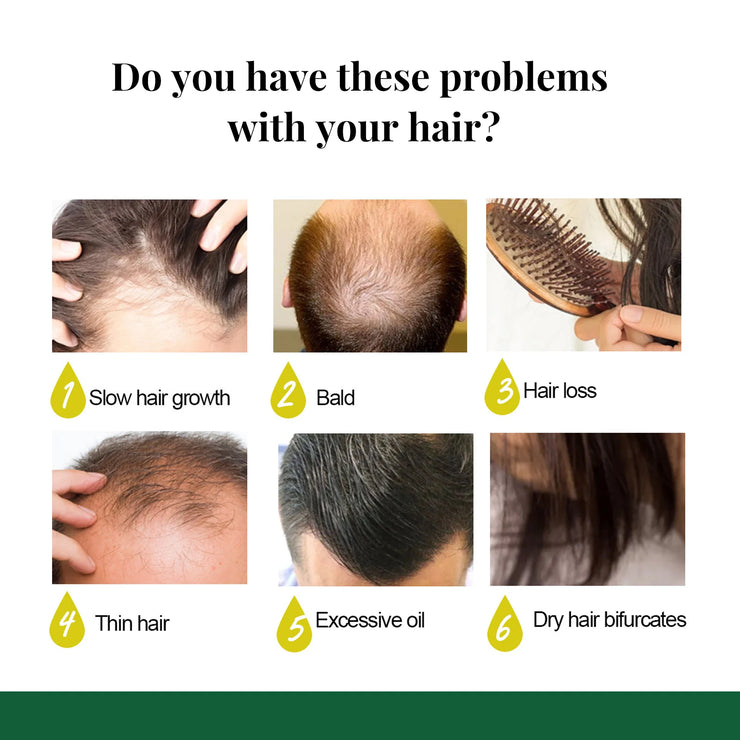 Ginger Hair Growth Spray Anti Hair Loss Scalp Nourishing Essence