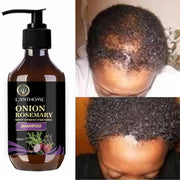 Rosemary Onion Shampoo Anti Hair Loss