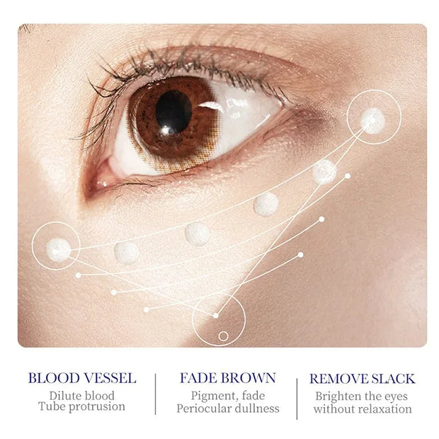 Kollagen-Retinol-Augencreme gegen Augenringe und Tränensäcke