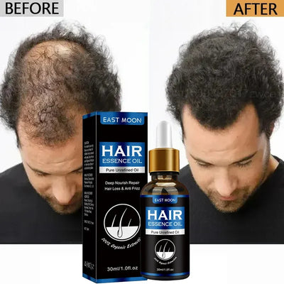 Hair Growth Oil Fast Repair for Hair Loss and Baldness