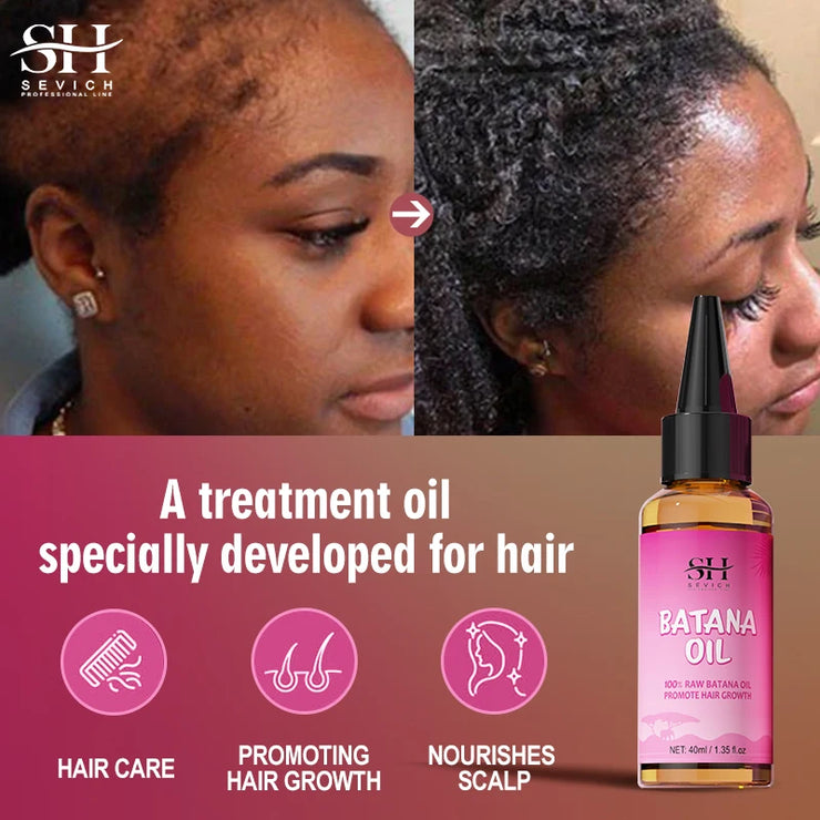 Hair Growth and Anti Hair Loss Treatment