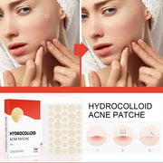 Acne Pimple Patches Invisible Spot Treatment