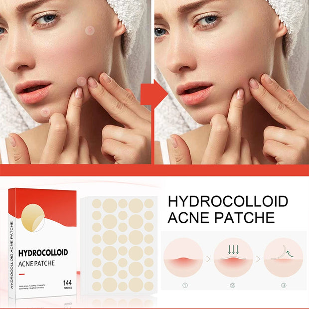 Acne Pimple Patches Invisible Spot Treatment