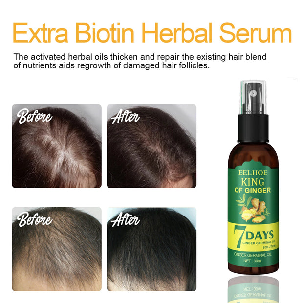 Ginger Hair Growth Spray Anti Hair Loss Scalp Nourishing Essence