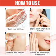 Acne Pimple Patches Invisible Spot Treatment