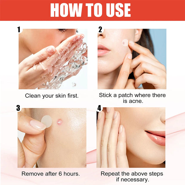 Acne Pimple Patches Invisible Spot Treatment
