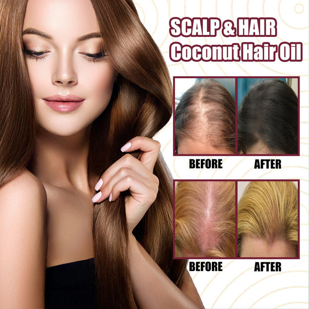 Hair Growth Oil Anti Hair Loss Spray with coconut oil benefits, showing before and after results for scalp and hair thickening in women.