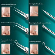 Ingrown Hair and Blackhead Removal Kit