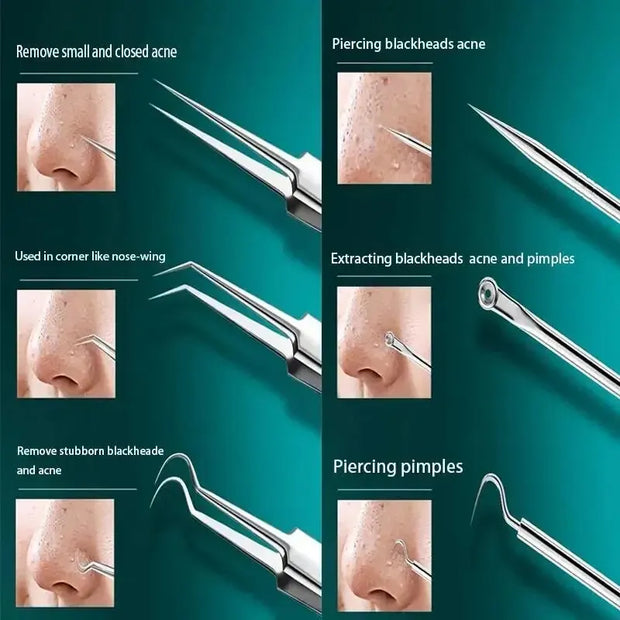 Ingrown Hair and Blackhead Removal Kit