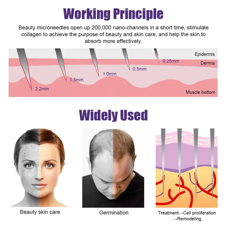 Beard Growth Kit with Microneedle Roller for Thicker Fuller Beard showing microneedle penetration depths and benefits for skin and hair regrowth. Ideal for stimulating collagen and enhancing beard growth.